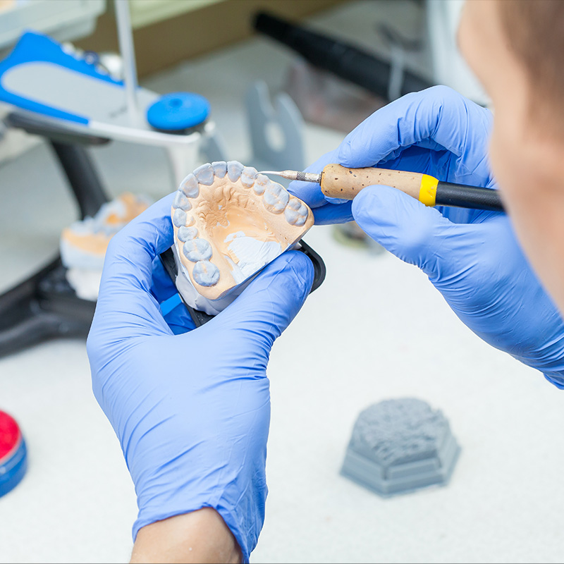 Granger Dentistry | Night Guards, Laser Dentistry and Inlays amp Onlays