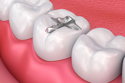 Granger Dentistry | Botox reg , All-on-6 reg  and VELscope reg  Cancer Screening