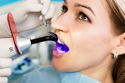 Granger Dentistry | All-on-6 reg , Sports Mouthguards and Crowns  amp  Caps