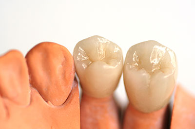Granger Dentistry | Digital Impressions, CBCT and Oral Exams