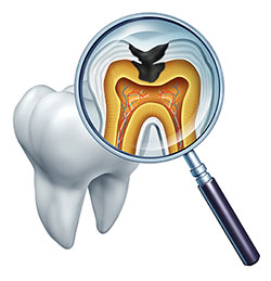 Granger Dentistry | Veneers, TMJ Disorders and Preventative Program