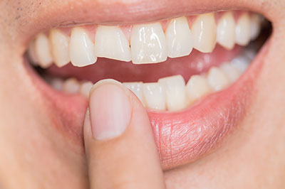 Granger Dentistry | Sleep Apnea, Sedation Dentistry and Periodontal Treatment