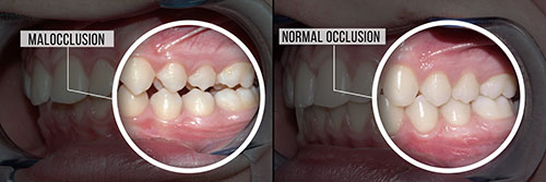 Granger Dentistry | Digital Radiography, Juvederm reg  and Dental Bridges