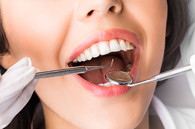 Granger Dentistry | Periodontal Treatment, Inlays  amp  Onlays and Dental Fillings