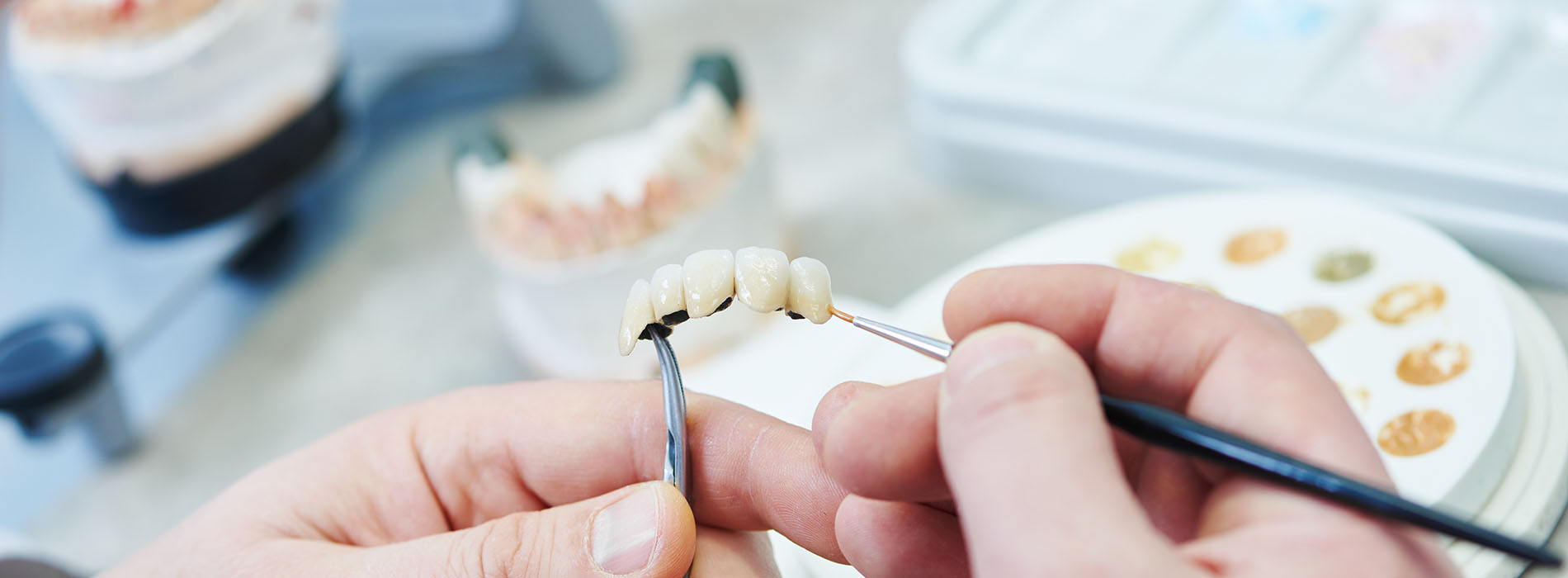 Granger Dentistry | Extractions, E4D and All-on-6 reg 