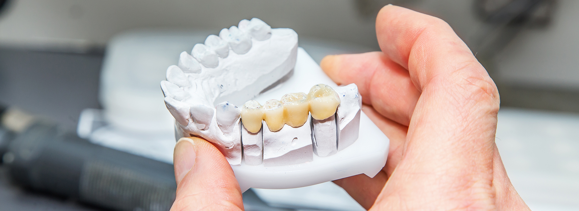 Granger Dentistry | Dental Fillings, Cosmetic Dentistry and Digital Radiography