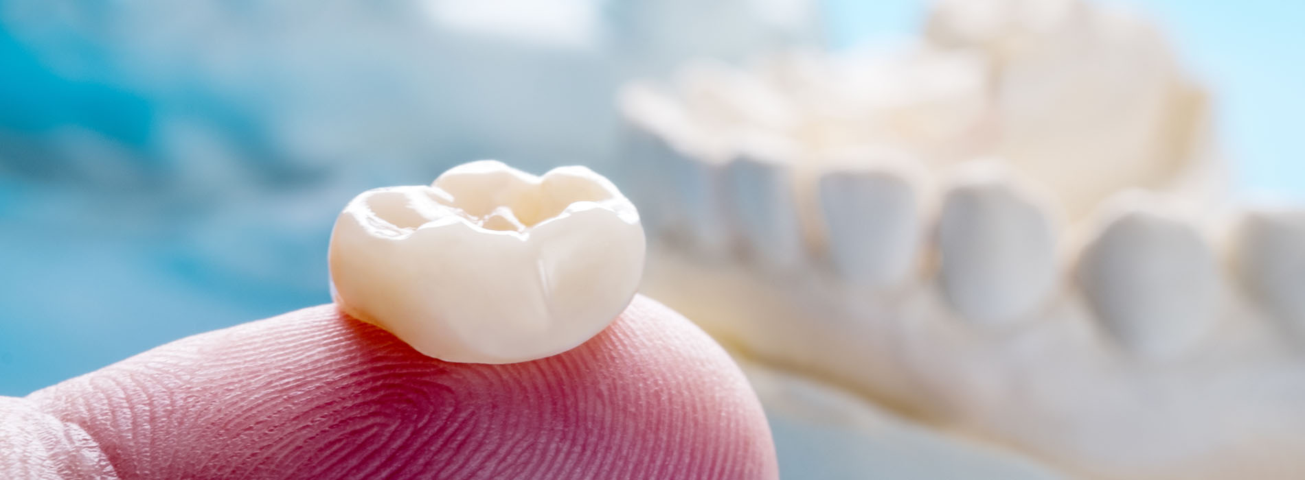 Granger Dentistry | Implant Dentistry, Dermal Fillers and Dental Sealants