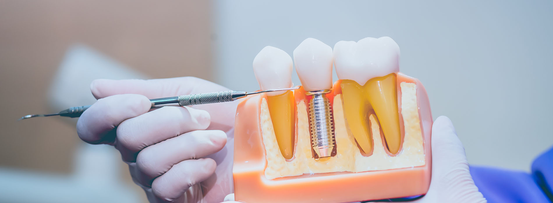 Granger Dentistry | TMJ Disorders, Fluoride Treatment and Sports Mouthguards