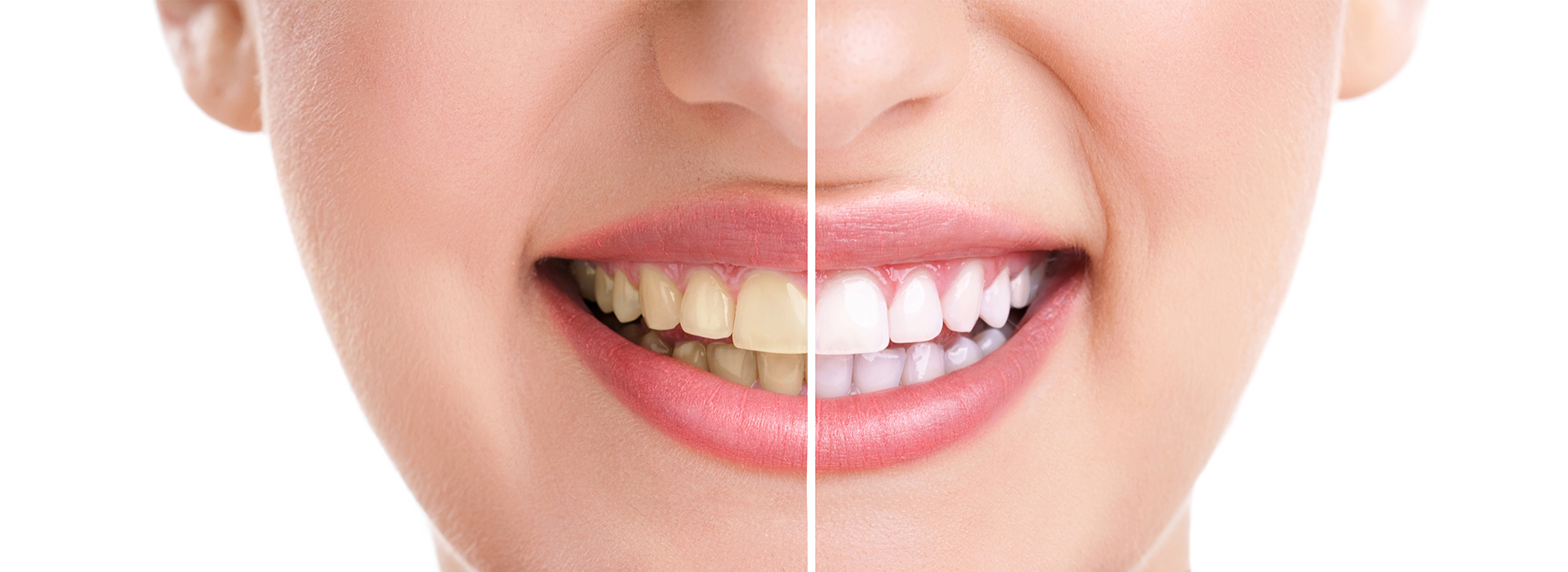 Granger Dentistry | Oral Cancer Screening, Full Mouth Reconstruction and CBCT