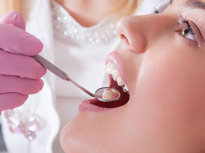 Granger Dentistry | Extractions, Night Guards and Laser Dentistry