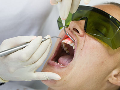 Granger Dentistry | Extractions, Pediatric Dentistry and Inlays  amp  Onlays